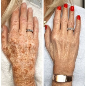 ��� ������� ���� ���������: 4 ��������, ������� ������� ���������� �� ���������� �����