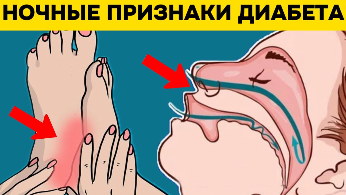 7 тревожных ночных симптомов диабета